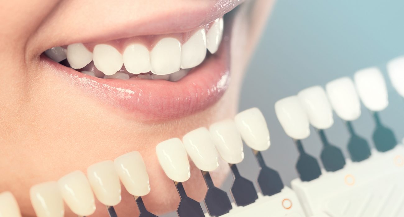 Which Procedures Fall Under Cosmetic Dentistry? 