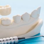 What is the Difference Between Getting Dental Implants and Having Them Restored?
