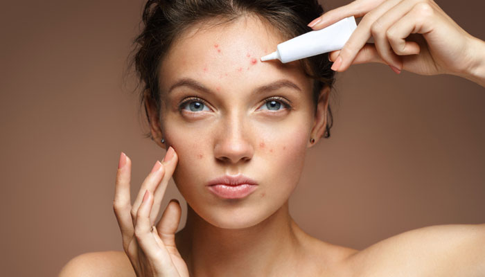 Acne Skincare Routine You Should Know