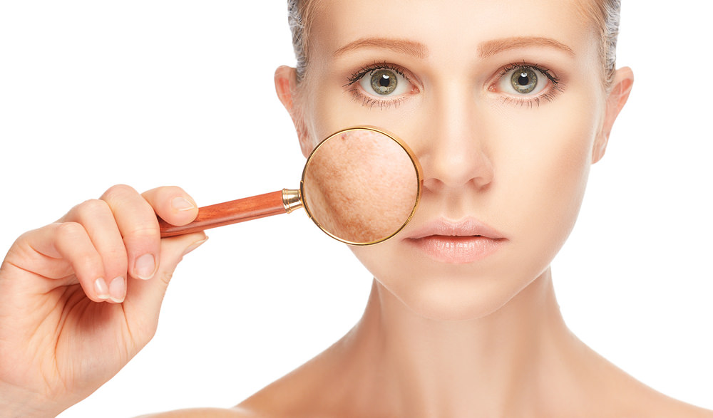 Comparing Pigmentation Removal Methods: Choosing the Right Approach for You