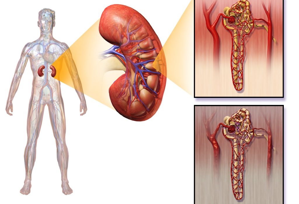 Infections and Disorders of the Urinary System