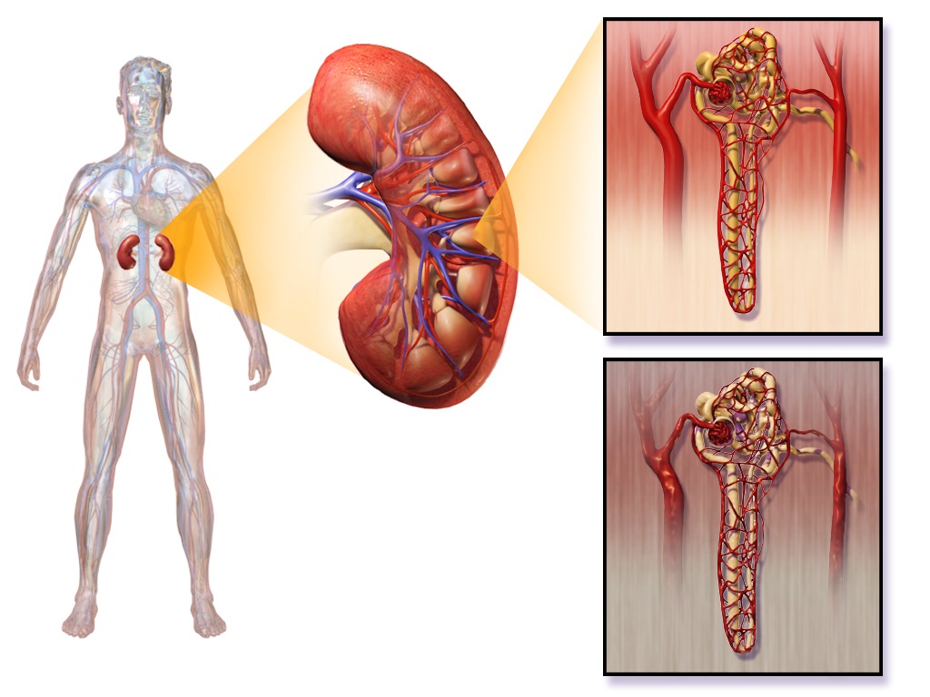 Disorders of the Urinary System